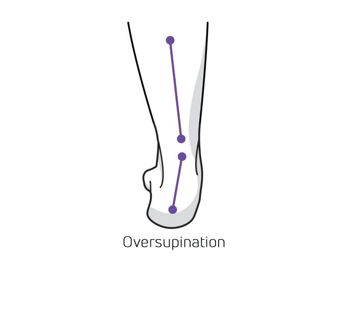 https://www.minfot.se/pub_docs/files/Hurvetjagomjagpronerarellersupinerar/overdriven-supination.jpg