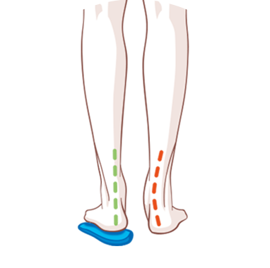 https://www.minfot.se/pub_docs/files/Vadärpronationskor/pronation.png