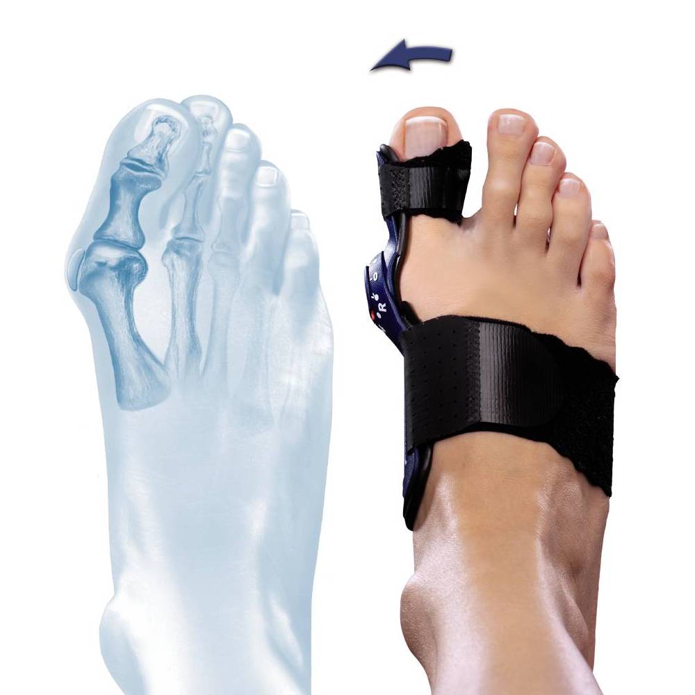 ortos-hallux-valgus-valguloc-II.jpg